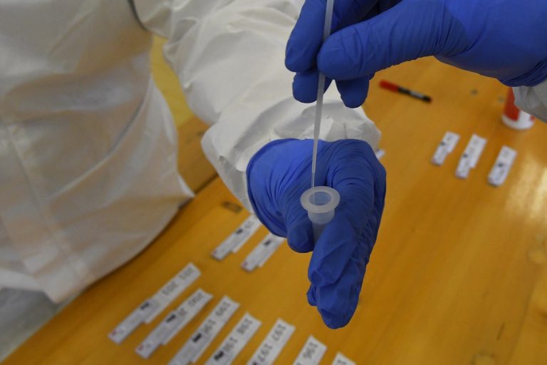 antigénové testovanie