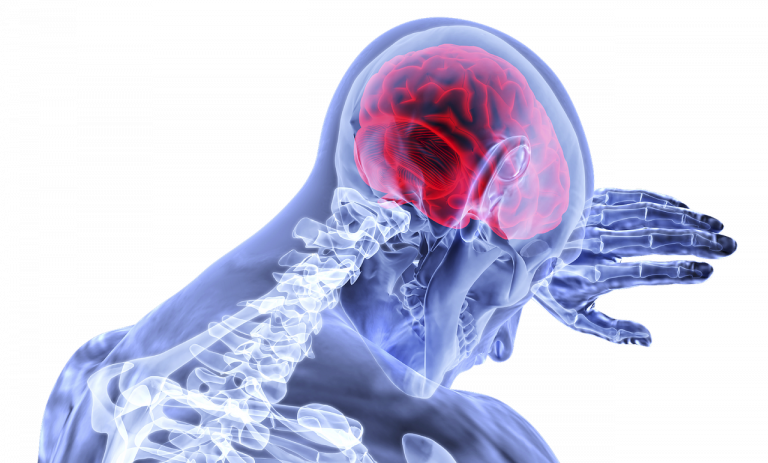 mozog, neurologické ochorenia