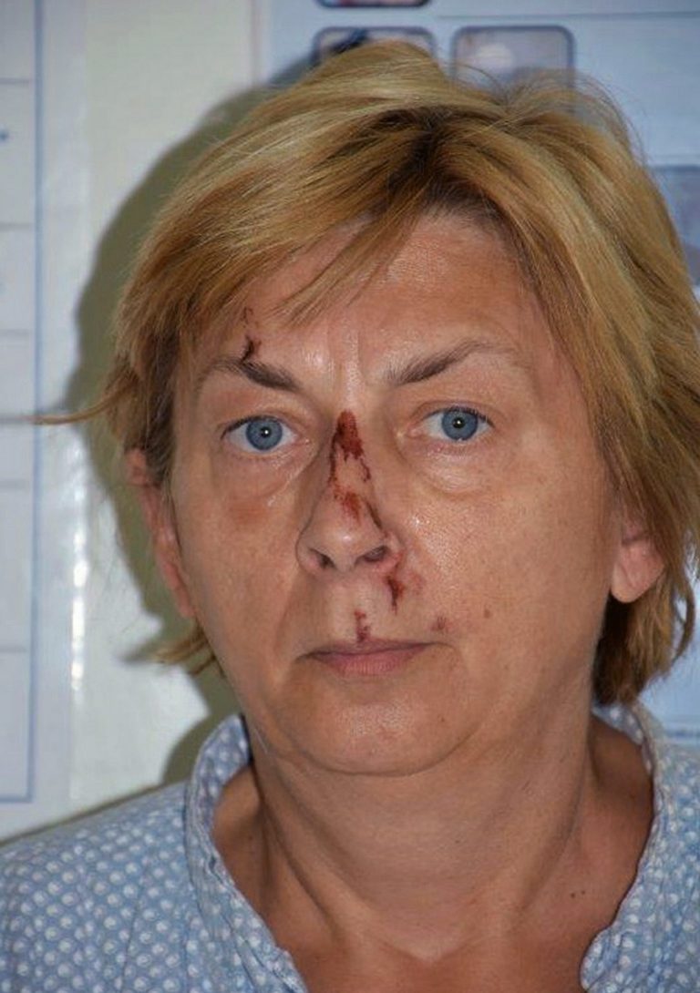 neznáma žena