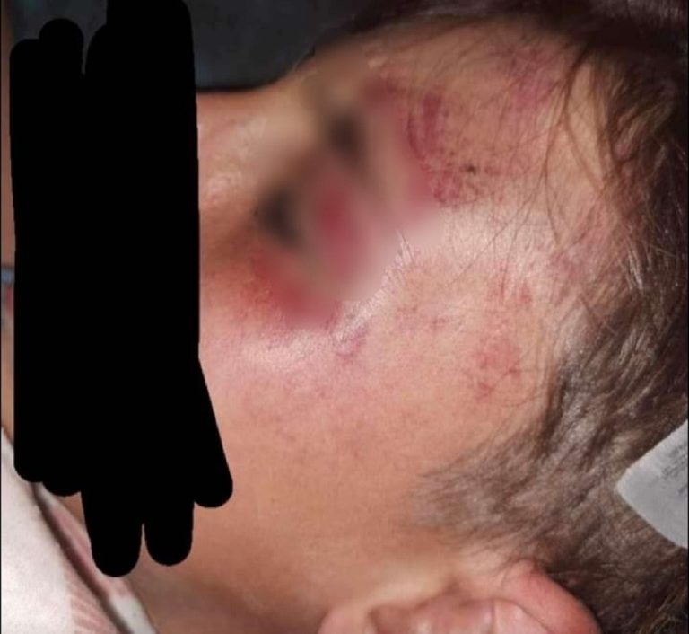 V Hlohovci sa stala ďalšia bitka medzi tínedžermi